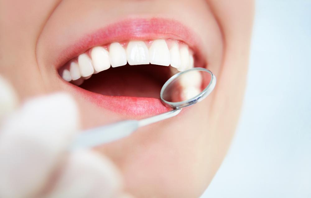 close up of woman's smile being looked at by dental mirror
