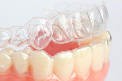 close up of invisalign clear aligner l dental clinic clifton hill vic