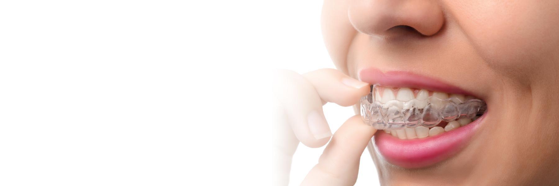Close up of woman holding clear braces