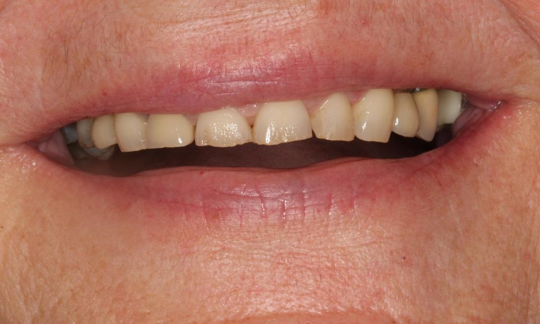 Image before dental treatment of the patient